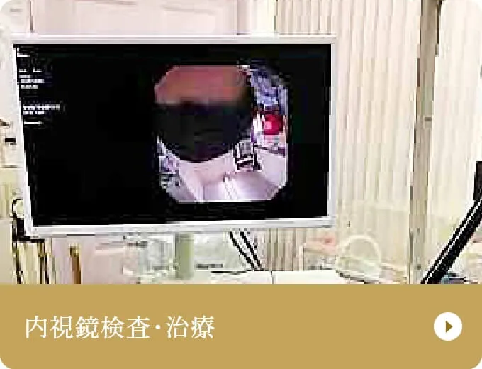 内視鏡検査･治療
